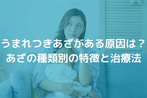 赤痣|うまれつきあざがある原因は？あざの種類別の特徴と。